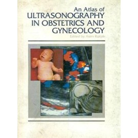 Atlas of Ultrasonography in Obs. & Gynaecology