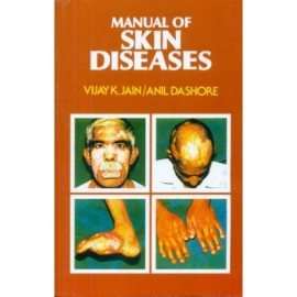 Manual of Skin Diseases