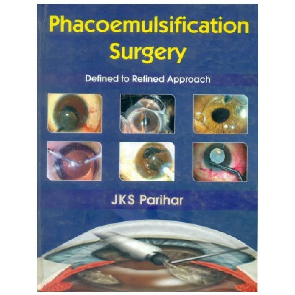 Phacoemuslification Surgery: Defined to Refined Approach (HB)