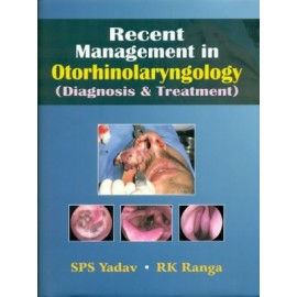 Recent Management in Otorhinolaryngology (Diagnosis and Treatment)