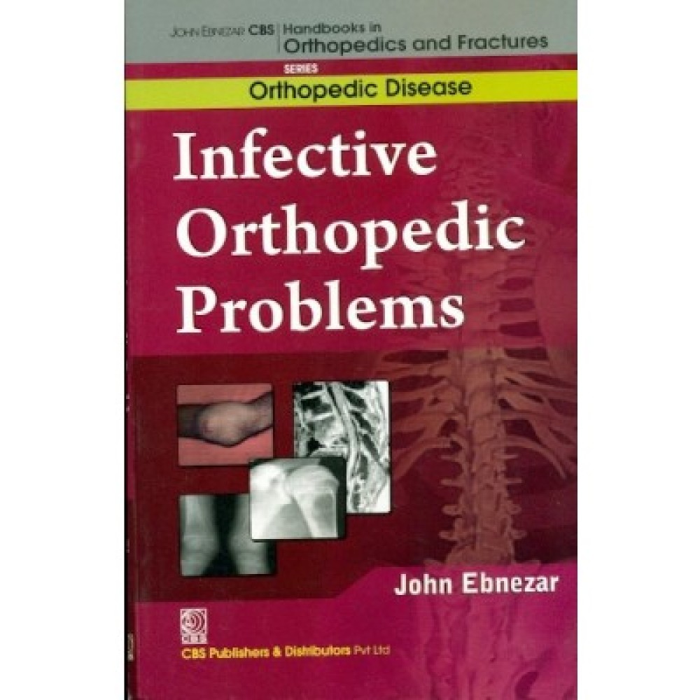 John Ebnezar CBS Handbooks in Orthopedics and Fractures: Orthopedic Disease : Infective Orthopedic Problems