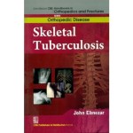 John Ebnezar CBS Handbooks in Orthopedics and Fractures: Orthopedic Disease : Skeletal Tuberculosis