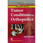 John Ebnezar CBS Handbooks in Orthopedics and Fractures: Orthopedic Disease :Tumor Conditions in Orthopedics