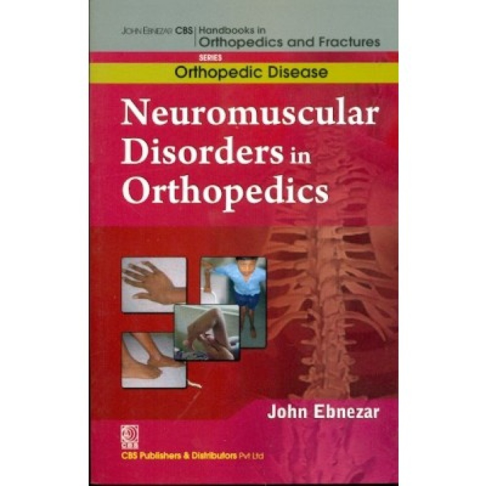 John Ebnezar CBS Handbooks in Orthopedics and Fractures: Orthopedic Disease :Neuromuscular Disorders in Orthopedics