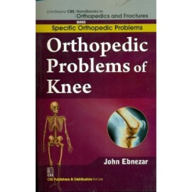 John Ebnezar CBS Handbooks in Orthopedics and Fractures: Specific Orthopedic Problems :Orthopedic Problems of  Knee