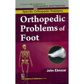 John Ebnezar CBS Handbooks in Orthopedics and Fractures: Specific Orthopedic Problems :Orthopedic Problems of  Foot