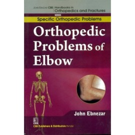 John Ebnezar CBS Handbooks in Orthopedics and Fractures: Specific Orthopedic Problems : Orthopedic Problems of  Elbow