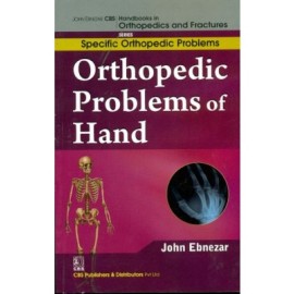 John Ebnezar CBS Handbooks in Orthopedics and Fractures: Specific Orthopedic Problems : Orthopedic Problems of  Hand