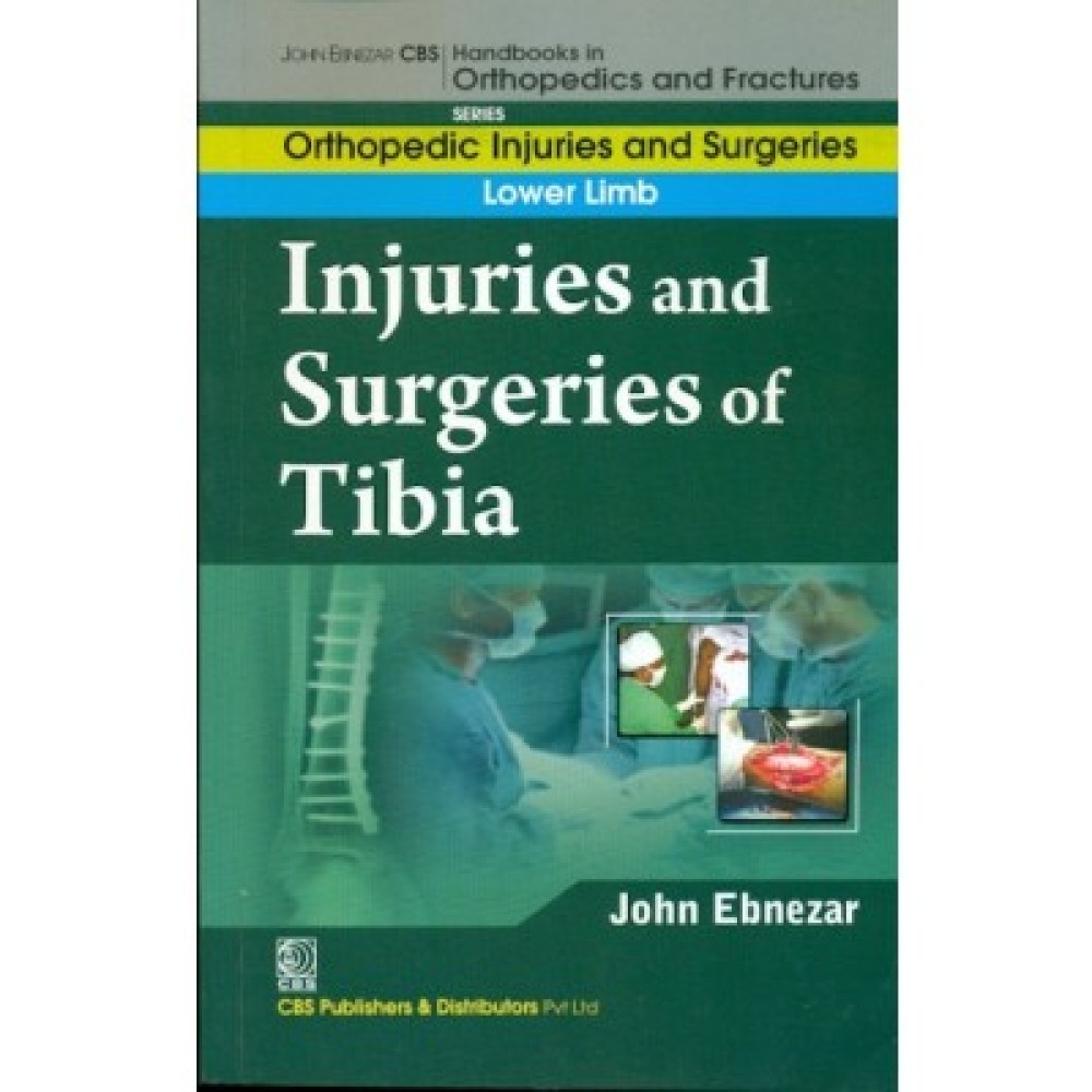 John Ebnezar CBS Handbooks in Orthopedics and Fractures: Orthopedic Injuries and Surgeries : Lower Limb : Injuries and Surgeries of Tibia