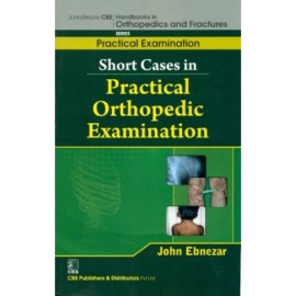 John Ebnezar CBS Handbooks in Orthopedics and Fractures: Practical Examination : Short Cases in Practical Orthopedic Examinations