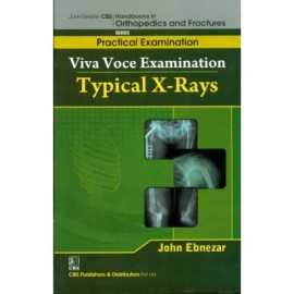 John Ebnezar CBS Handbooks in Orthopedics and Fractures: Practical Examination : Viva Voce Examination: Typical X-Rays