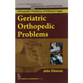 John Ebnezar CBS Handbooks in Orthopedics and Fractures: Orthopedic Problems of Different Ages : Geriatric Orthopedic Problems