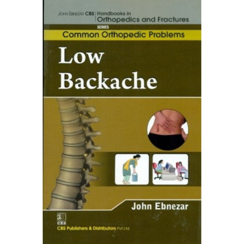 John Ebnezar CBS Handbooks in Orthopedics and Fractures: Common Orthopedic Problems  : Low Backache