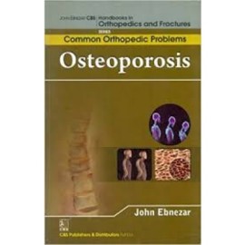 John Ebnezar CBS Handbooks in Orthopedics and Fractures: Common Orthopedic Problems  : Osteoporosis