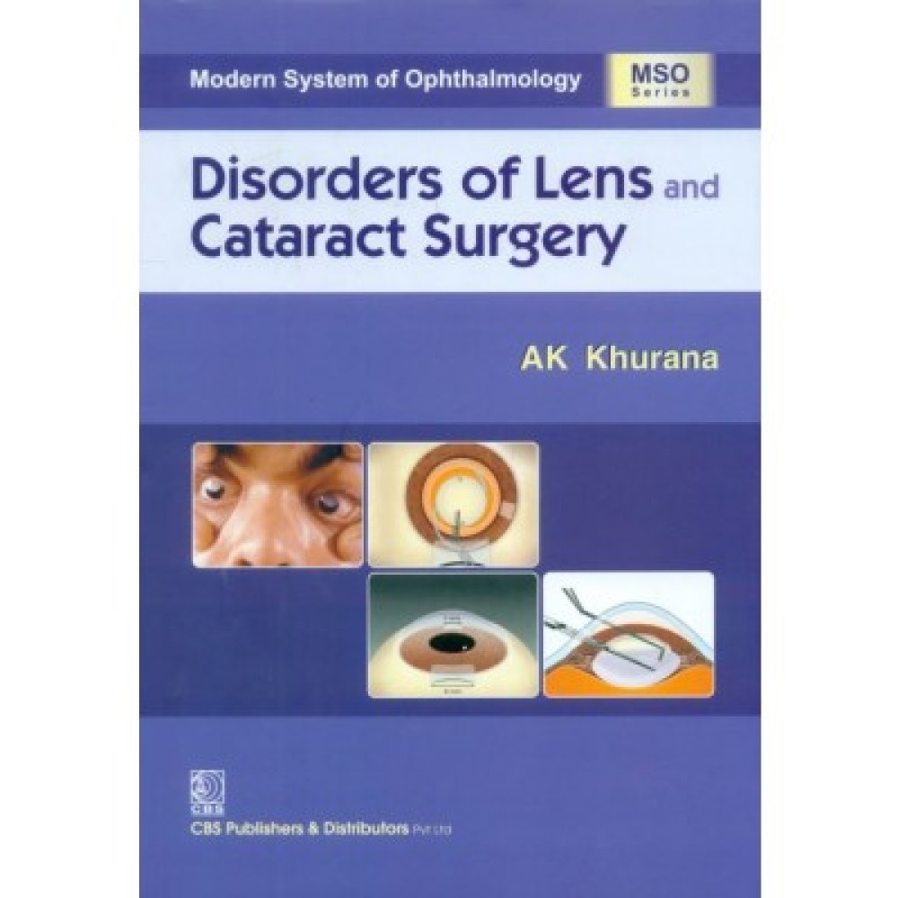 Modern System of Ophthalmology: Disorders of Lens & Cataract Surgery (HB)