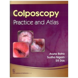 Colposcopy—Practice and Atlas