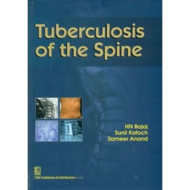 Tuberculosis of the Spine (HB)