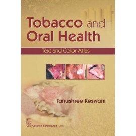 Tobacco and Oral Health: Text and Color Atlas (PB)