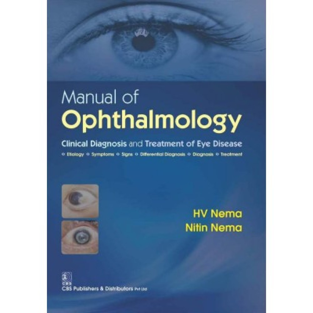 Manual of Ophthalmology: Clinical Diagnosis and Treatment of Eye Disease (PB)