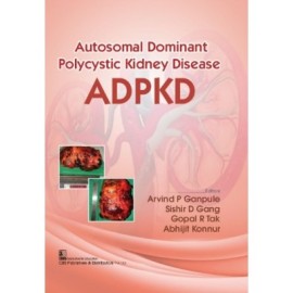 Autosomal Dominant Polycystic Kidney Disease Adpkd (Flexibond 2022)