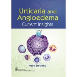 Urticaria And Angioedema Current Insights (PB)