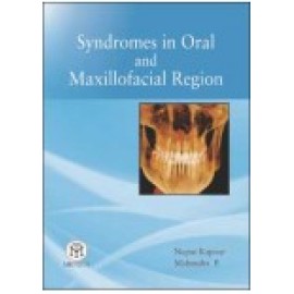 Syndromes In Oral And Maxillofacial Region (Pb)