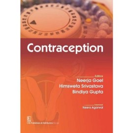 Contraception