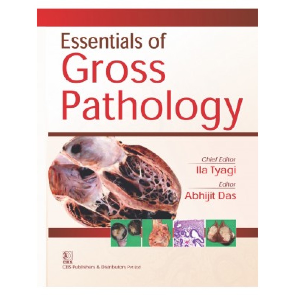 Essentials of Gross Pathology