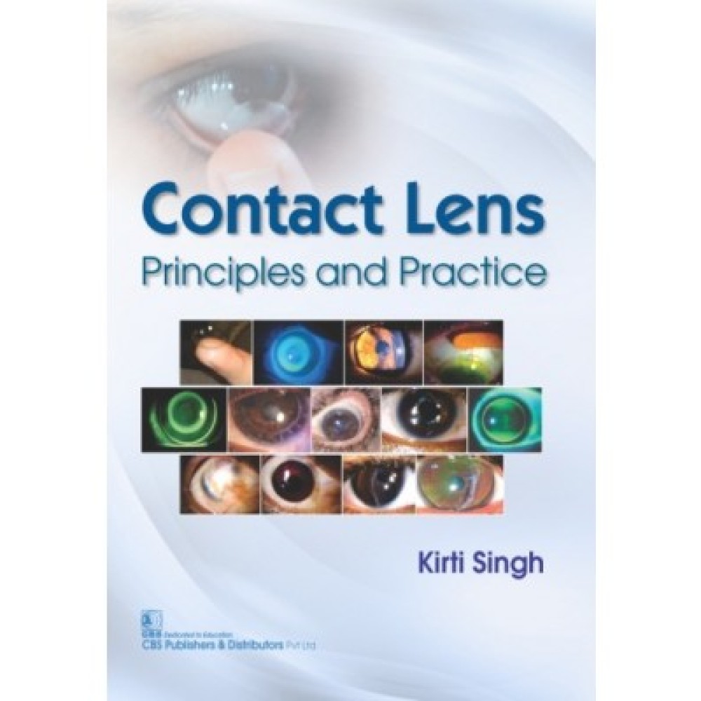 Contact Lens Principles and Practice (Pb)