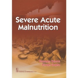 Severe Acute Malnutrition (PB)