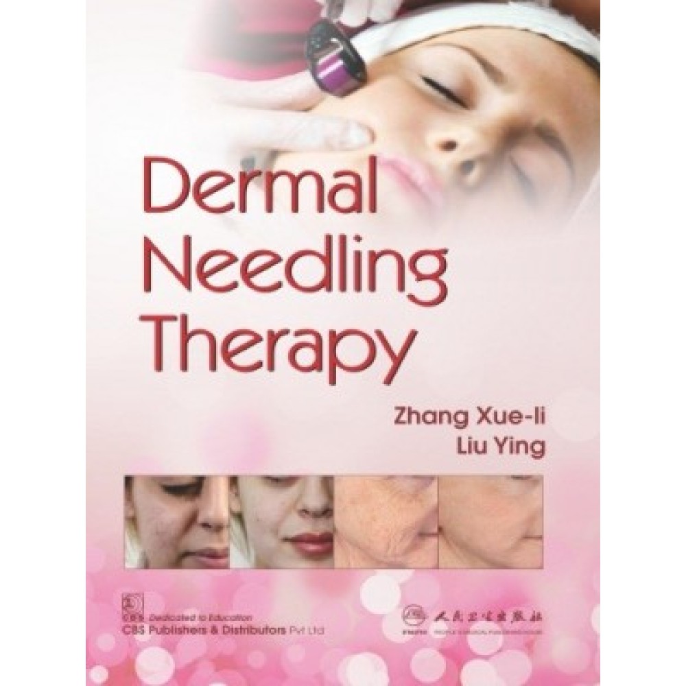 Dermal Needling Therapy (PB)