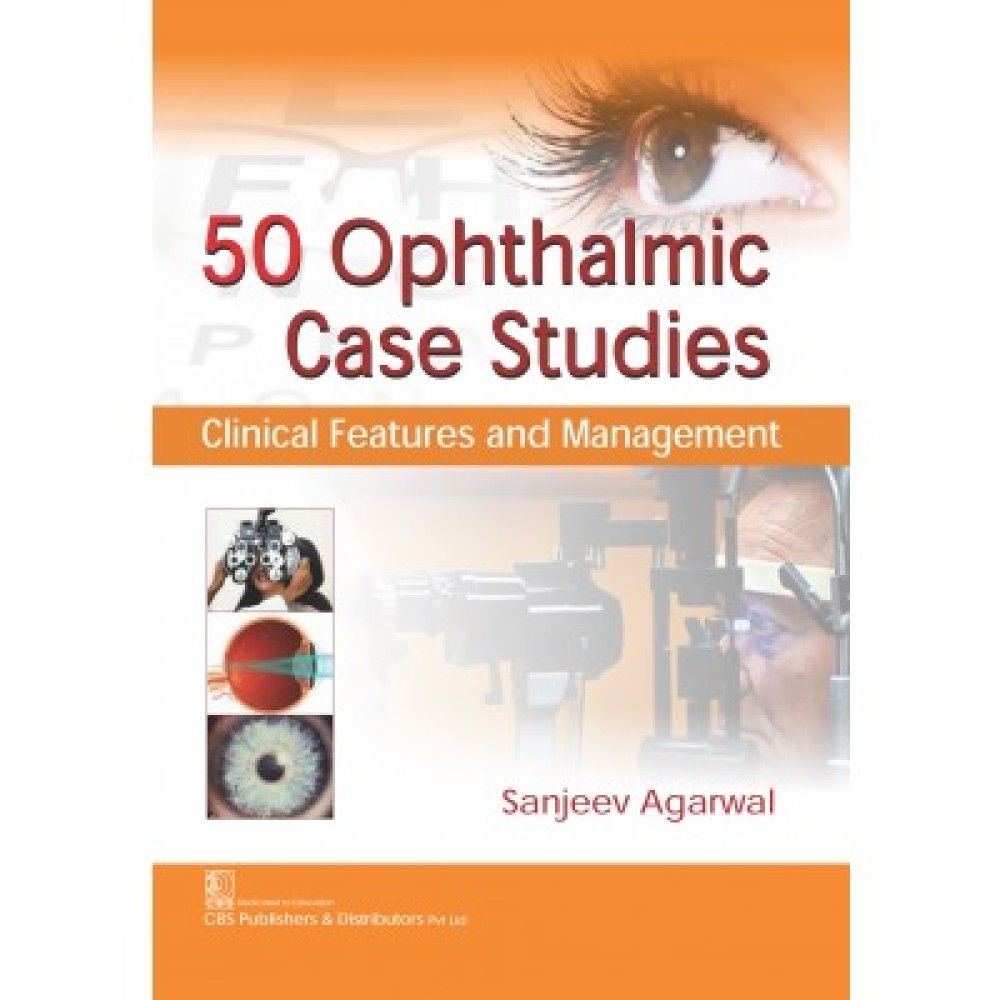 50 Ophthalmic Case Studies: Clinical Features and Management (PB)