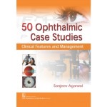 50 Ophthalmic Case Studies: Clinical Features and Management (PB)