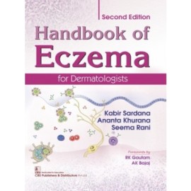 Handbook of Eczema for Dermatologists, 2e (HB)
