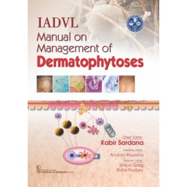 IADVL Manual On Management of Dermatophytoses (HB)