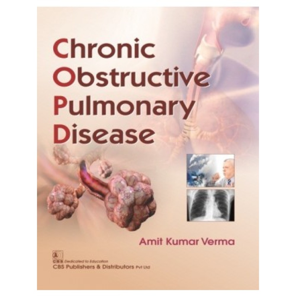 Chronic Obstructive Pulmonary Disease (PB)