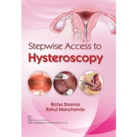 Stepwise Access to Hysteroscopy (HB)